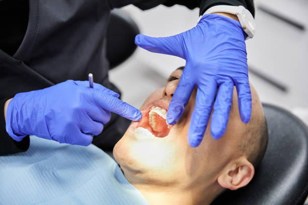 Best Emergency Broken Tooth Repair in Keokea, HI